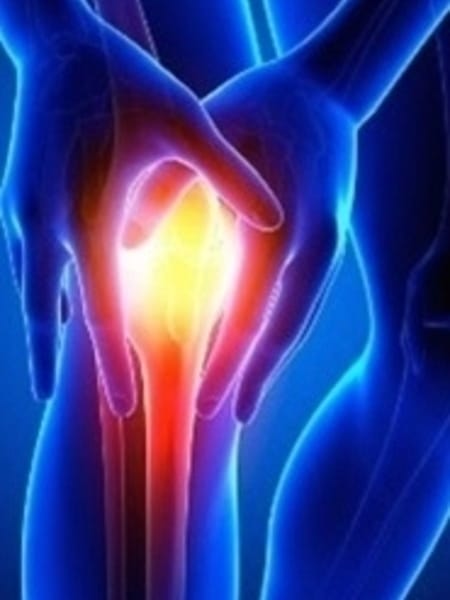 Arthritis Essential Oil Blend