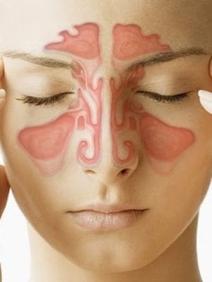 Sinus Essential Oil Blend